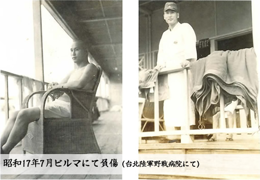 昭和17年7月ビルマにて負傷(台北陸軍野戦病院にて)